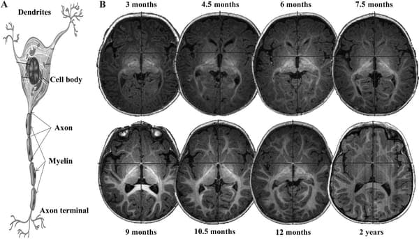 The Early Years of Brain Development: A Window into Cognitive Growth and Neuropsychiatric Risk